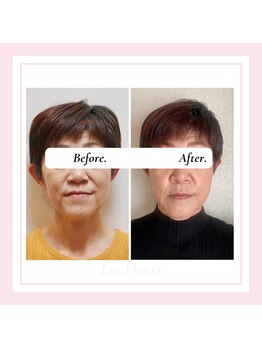 ル フラーズ(Les Fleurs)/50代後半のお客様