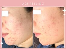 シロカネ イオンタウン西熊本店(SHIROKANE)/アギピーリング☆