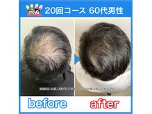 おいけ美容整体院 桐生院の雰囲気（ダイエット専用機器で脂肪にアプローチ!!）