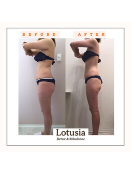 ルトゥーシア(Lotusia)の写真/最新痩身機器で結果だし◎ラジオ波/キャビテーション/EMSなどの複合機器使用！どんな脂肪にもアプローチ。