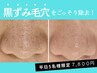 平日限定！【毛穴の黒ずみ】撃退！毛穴洗浄コース50分12,000円→7,800円