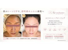 リアンシャンテ(Re enchanter)の雰囲気(鏡を見るのが楽しみになる肌へ)