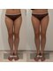 ケアナ 梅田(CareNa)の写真/たった60分でこの変化★ハイパーナイフ×メロンボトル×熟練ハンドで本気痩身