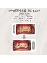 プラスビーセルフ(+b self)/ホワイトニングビフォーアフター