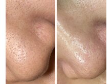 サイ(Sai)/before⇒after