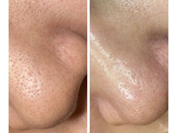 サイ(Sai)/before⇒after