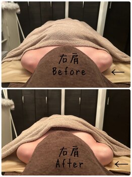 フィール(feel)/Before/After 整体+リンパ