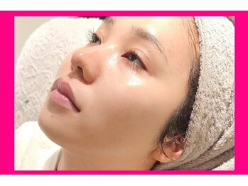 アン 銀座(ann)/メソスキンカラー