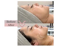 食いしばり、左右差、浮腫、慢性的な首凝りはお任せください！