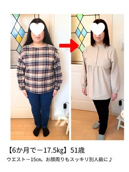 ラ ミニョン/【6か月で－17.5キロ】51歳