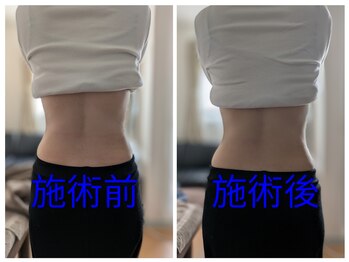 よしなが整体院/後ろ姿もスッキリ！