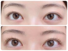 トータルビューティ ノイド(Noid)/パリジェンヌ＆眉WAX脱毛