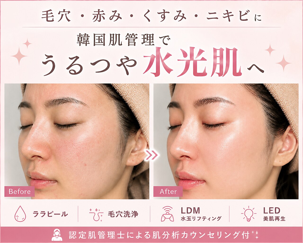 バブルビューティー(Bubble beauty)｜ホットペッパービューティー