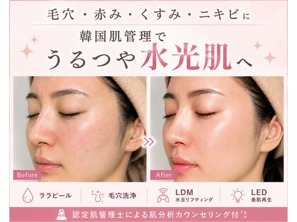 バブルビューティー(Bubble beauty)の写真