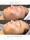エイル(EILE)の写真/繰り返すニキビや赤みに終止符を。韓国肌管理で目指す憧れのノーファンデ肌へ☆