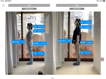 ナオル整体 大森店(NAORU整体)/60代女性、継続施術5ヶ月経過後