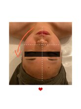 チョンダムビューティー(chondam beauty)/初めての小顔コルギに挑戦！