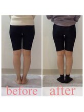 スタイルラボ高松/産後骨盤矯正の効果♪