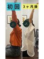 ユア(your.) 3回の猫背矯正前後