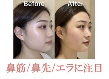 ラプリシュシュ 岡山店(Raplit)