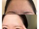 スターラッシュ 脱毛とハーブピーリングのプロ(Star Lash)の写真