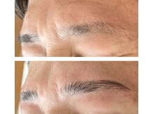 クラージュ(Courage)/men'sハリウッドブロウリフト