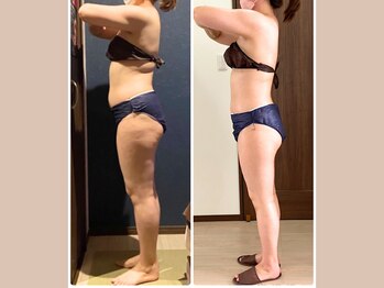リライブ 亀有店(Re:Lives)/全身ビフォーアフター【痩身】
