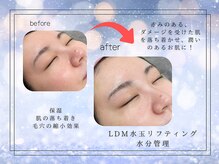 スア(SUA)/LDM水玉リフティング