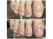 ミコ(.mico)の雰囲気（手術後や爪の脱落、義爪作成可能。）