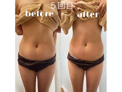 リリーボーテ 下北沢(LILY beaute)の写真