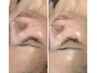 NEW【ツヤ肌】　潤艶肌フェイシャル　90分  月1しっかりメンテコース
