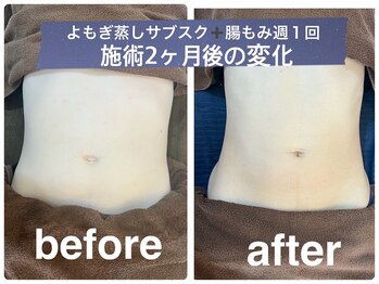 デューン 蕨店(Dune)/よもぎ蒸し/腸もみ