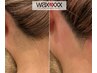 【大人気】うなじWAX脱毛＆高速美肌脱毛機・ダブル脱毛で綺麗に☆うなじ美人