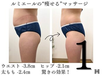 ルミエール 新宿御苑/本気痩身!実感技術!悩み解消!