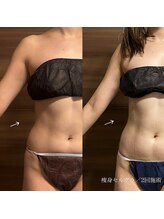 エクラ(eclat)/セルクラ