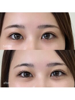 アイスタイル ビビ(Eye Style BiBi)/ブラックティント★