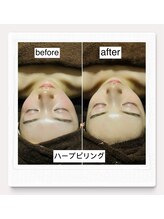 ルル リラクゼーション(RURU Relaxation)/陶肌ハーブピリング/肌質改善