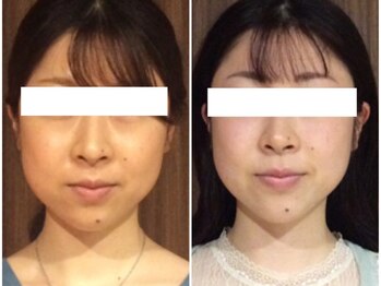 美容整体 ウェリナ 蟹江院/小顔矯正/骨盤矯正/美脚サロン