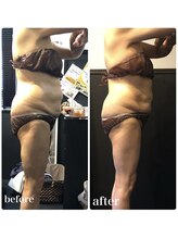 ピーラトゥ 日立(P-Ratu)/上半身集中◎