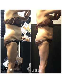 ピーラトゥ 日立(P-Ratu)/上半身集中◎