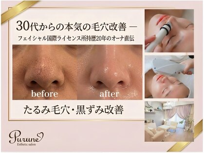 プルネ(Purune)の写真