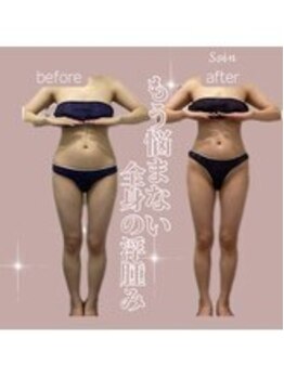ソワン 小岩店(Soin)/ アーユルヴェーダ
