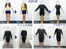 [小顔矯正 骨盤矯正 美容矯正] 銀座 美.design 熊本下通店 【7/9 NEW OPEN（予定）】/☆美脚O脚+骨盤矯正Before-After