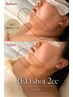 【二重あご・輪郭のもたつきに】すっきりシャープなフェイスラインへ ¥9,900