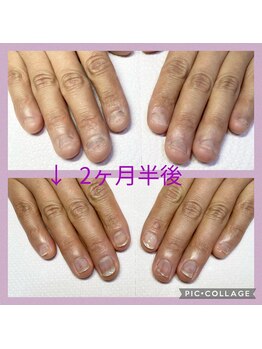 ブルームブルーム(BLOOMブルーム)/2ヶ月半後