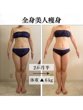 リルチェ 自由が丘(RILUCE)/全身美人痩身効果写真