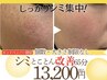 【ホットペッパー限定】とことんシミ改善60分!【個数・大きさ制限無し】