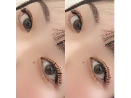 リリー(LILY)の写真