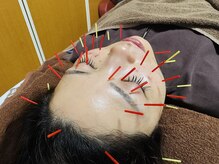 カラー(Calla)の雰囲気（結果にこだわった美容鍼灸や美容エステメニュー施術）