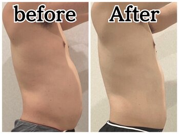 イデアルボーテ/メンズ痩身もお任せください！